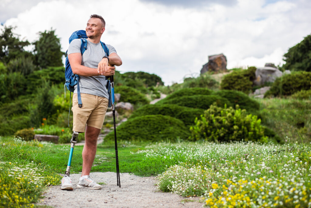 Positive young man with prosthesis standing outdoors while enjoying tourism